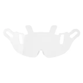 Endurance csere látómező